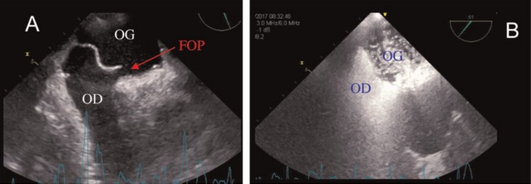 maladies rares en pediatrie 