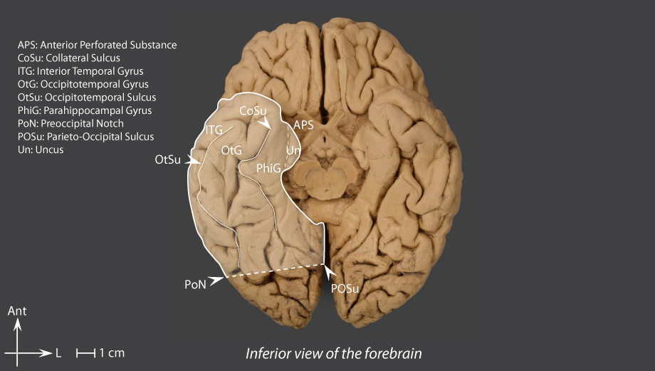 External Configuration Brain Inter Atlas